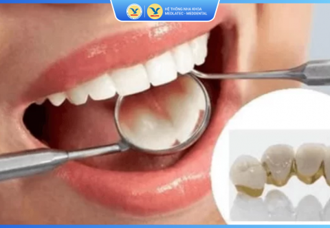 Đi Khám Răng Không Lo Chi Phí Với Khách Hàng My Viettel